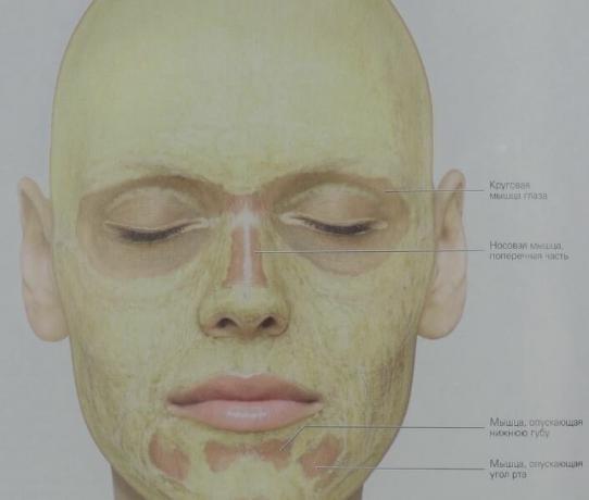 Das ist, wie subkutanes Fett wird in unserem Gesicht verteilt (gelb). In den kreisförmigen Muskeln der Augen Schicht aus Bindegewebe enthält fast kein Fett