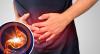 An einen entscheidenden „Nein“ Gastritis: 5 Tipps Profis