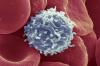 Wissenschaftler haben einen Weg gefunden, so dass die T-Zellen gefunden Krebs beginnen zu kämpfen