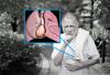 Ein Blutgerinnsel in den Lungenarterien: Verpassen Sie nicht die ersten Anzeichen
