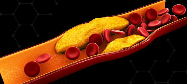 Cholesterin - Cholesterin