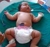 6 bis 8 kg: die größten Neugeborenen der Welt