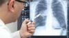Arzt vergleicht Strahlenbelastung mit CT der Lunge mit Strahlenbelastung in Hiroshima
