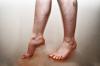 Verletzung von Blutfluss in den Beinen: Ursachen, Symptome