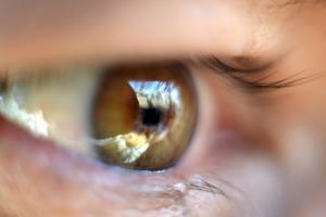 Netzhautablösung Augen: wie die Sehkraft zu retten?