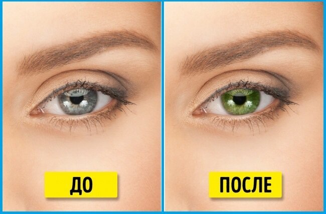 Veränderung der Augenfarbe