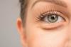 Säcke unter den Augen: Kosmetikerinnen beraten, wie loswerden