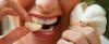 7 Möglichkeiten, wie man loswerden der Geruch von Knoblauch Mund bekommen