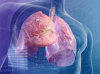 Der Tumor in der Lunge: 5 Zeichen