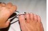 Wie problemlos rasieren starren, verdickte Fußnägel. Tipps Leser