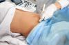 Wie oft muss man während der Schwangerschaft einen Ultraschall machen, sagt der Arzt