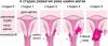 7 Anzeichen von Gebärmutterhalskrebs, die Frauen oft ignorieren